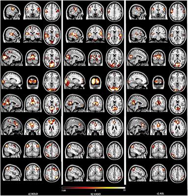 Comparison of Resting-State Brain Activation Detected by BOLD, Blood Volume and Blood Flow